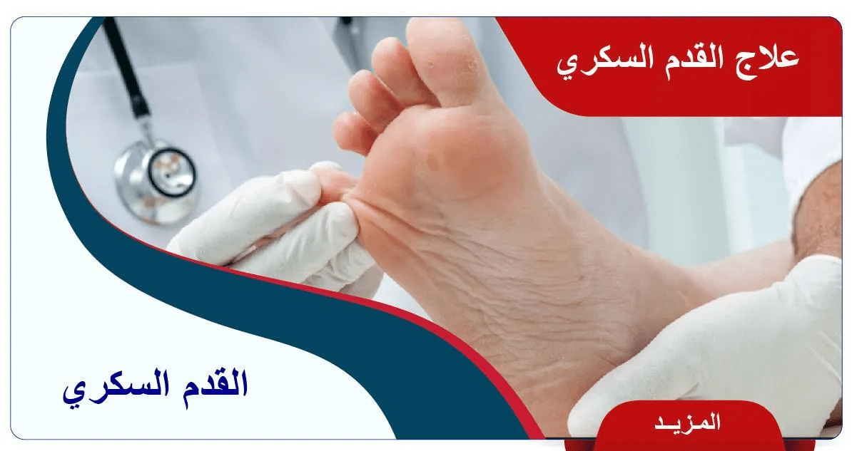القدم السكري.. أسئلة شائعة 